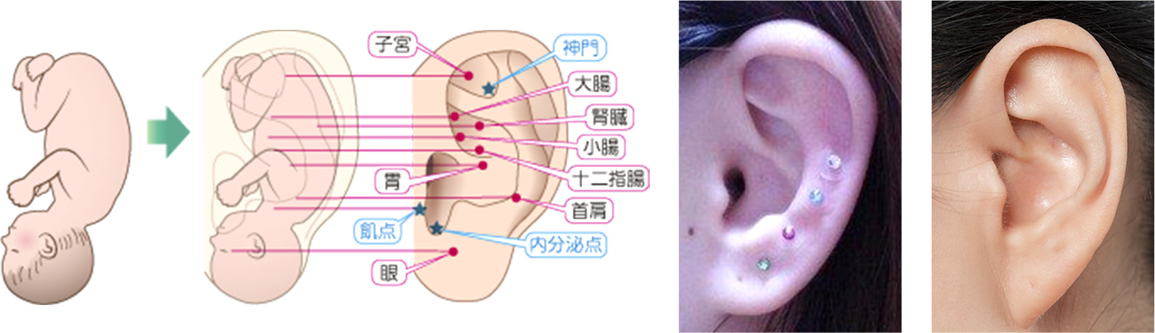 耳ツボ